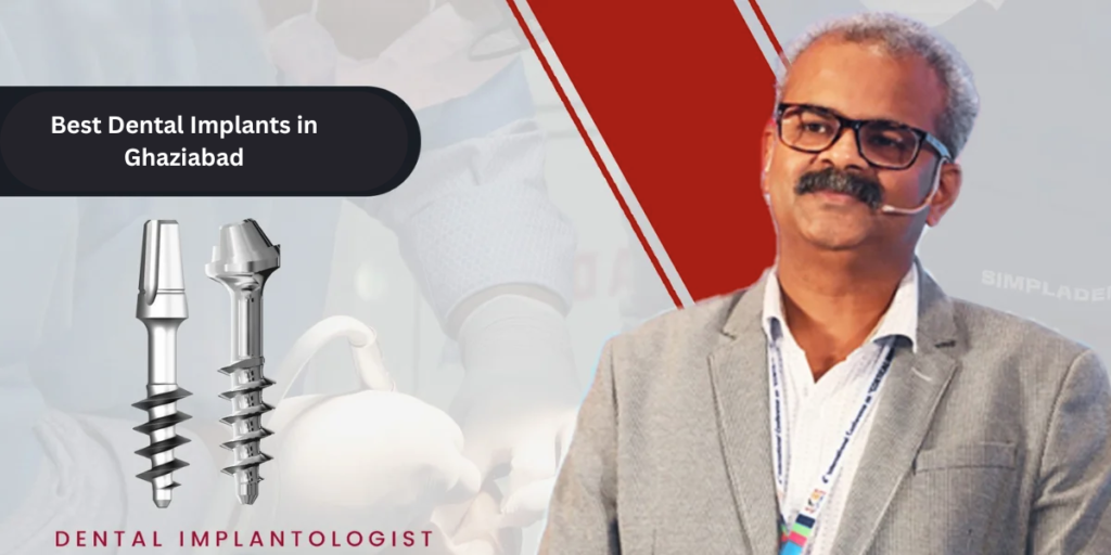 best dental implants in Ghaziabad