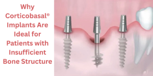 Corticobasal implants in India