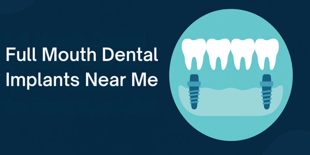 Full-mouth dental implants near me