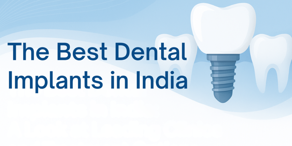 Best dental implants in India