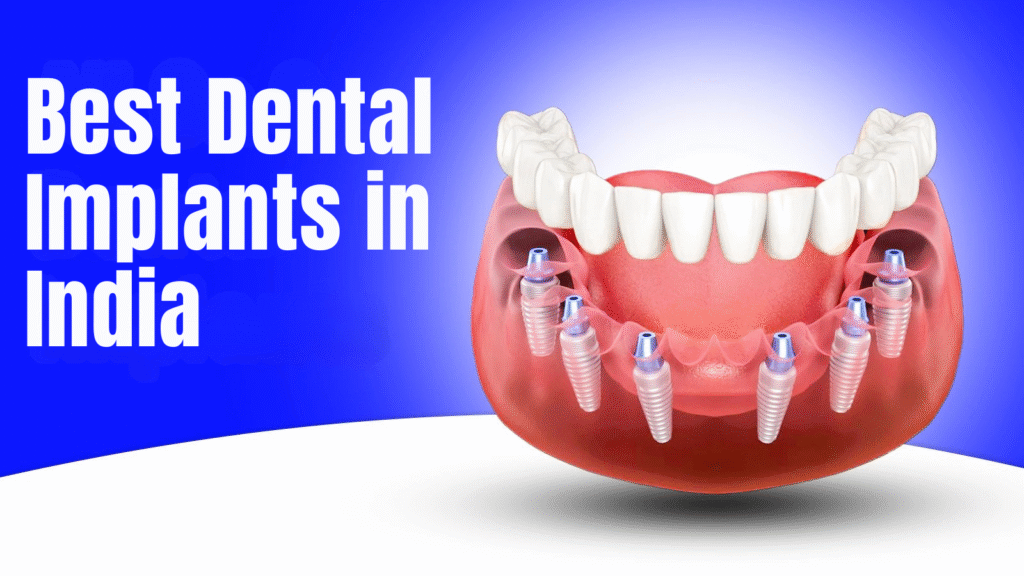 Affordable Dental Implants Delhi