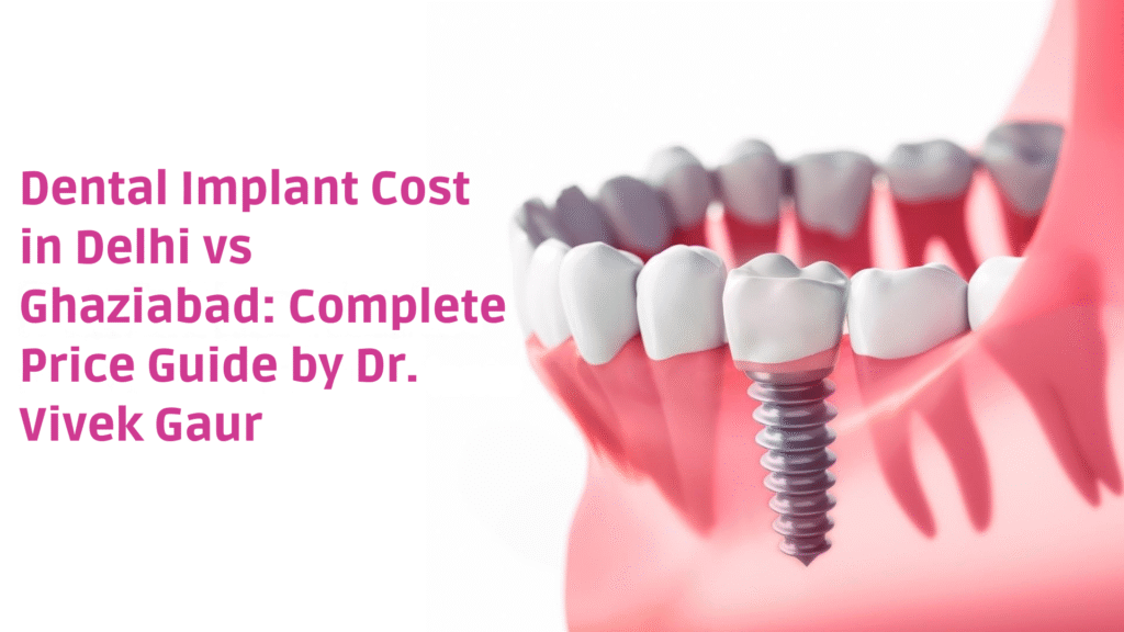 Dental Implant Cost Comparison Delhi Ghaziabad