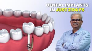 Dental Implant Procedure with Advanced Technology