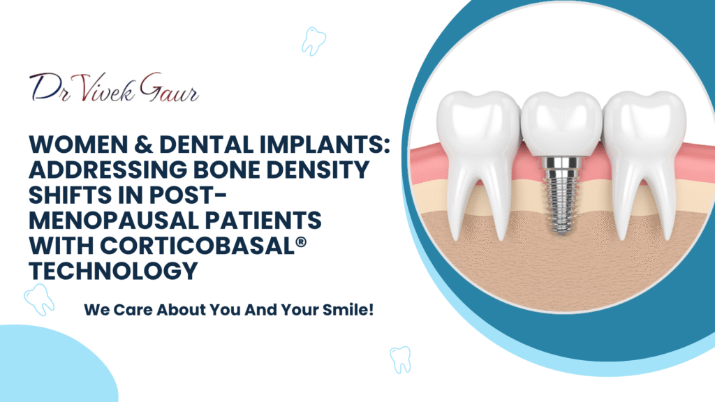 full-mouth dental implants India