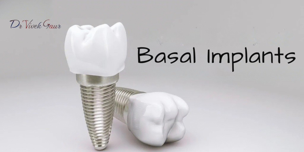 Basal Cortical Dental Implants
