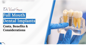 full mouth dental implants Ghaziabad clinic