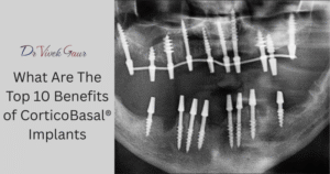 CorticoBasal® Basal Dental Implants