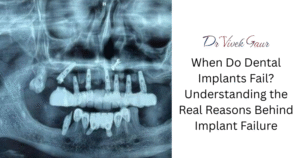 dental implant failure