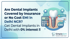 Best dental implants in India