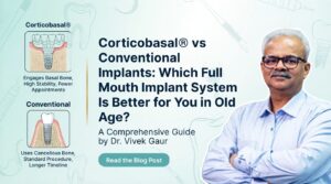 Full mouth dental implants India