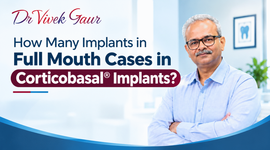 How Many Implants for Full Mouth Dental Implants, Corticobasal Implants Full Mouth Cases